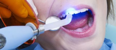 стоматологические клиники в хабаровске, лечение зубов, лечение зубов в хабаровске, лечение зубов цены