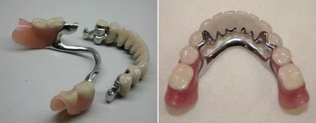 стоматология хабаровск, стоматологические клиники в, хабаровске, протезирование зубов, протезирование зубов цены, протезирование зубов в хабаровске, цены